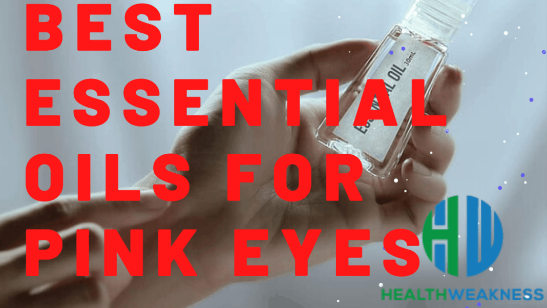 How To Use Essential Oils For Pink Eyes Showing 3 Overall Best Oils
