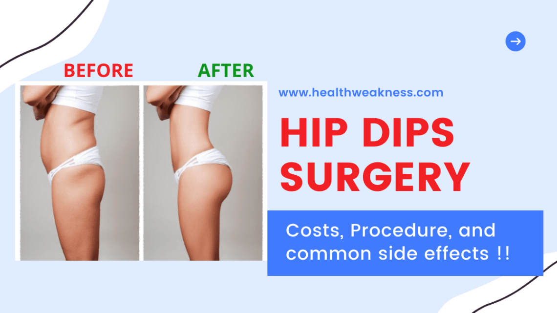 Hip Dips Surgery In 2022 Costs, Procedure, And Common Side Effects