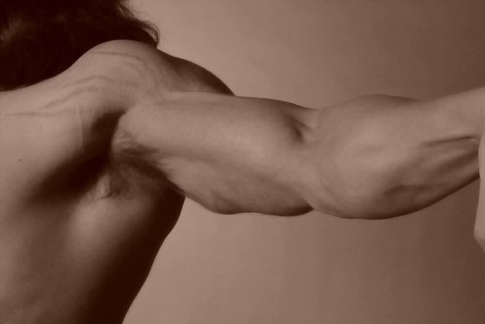 Bodybuilding stretch marks on biceps