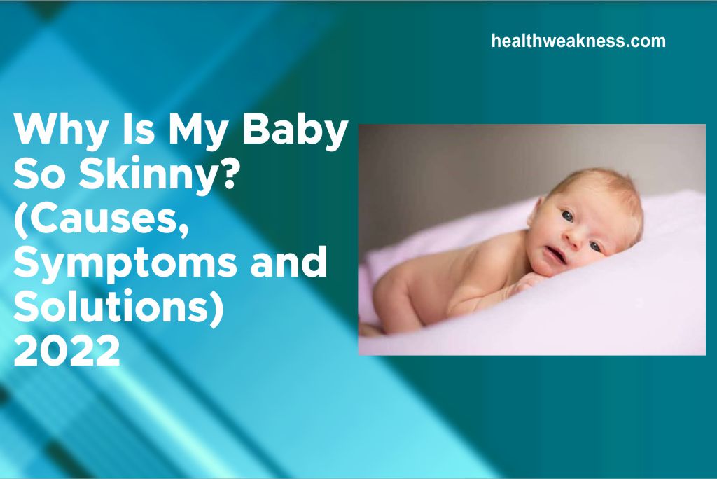Why Is My Baby So Skinny Causes, Symptoms and Solutions